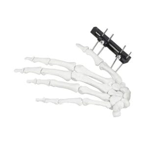 Producto 10 Fijador Compacto de Huesos de la Palma del Dedo para Pequeños Fragmentos de Precisión para Lesiones de la Mano